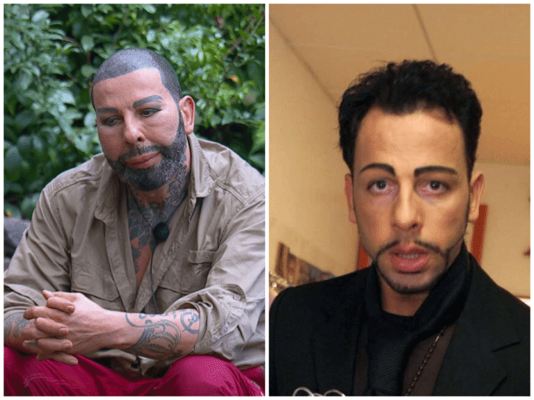 Harald Glööckler ungeschminkt – Ein seltener Blick hinter die glamouröse Fassade harald glööckler ungeschminkt